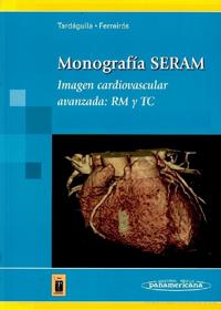 Imagen Cardiovascular Avanzada